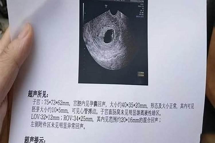 怎样看生男生女