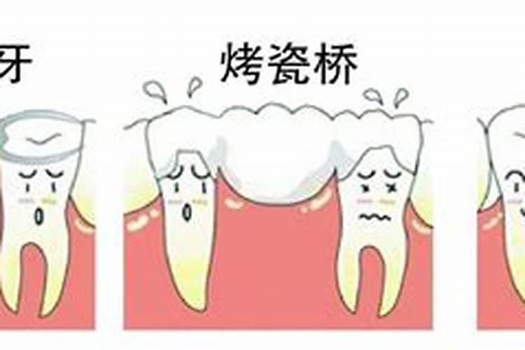 梦到牙齿掉了一颗是什么意思