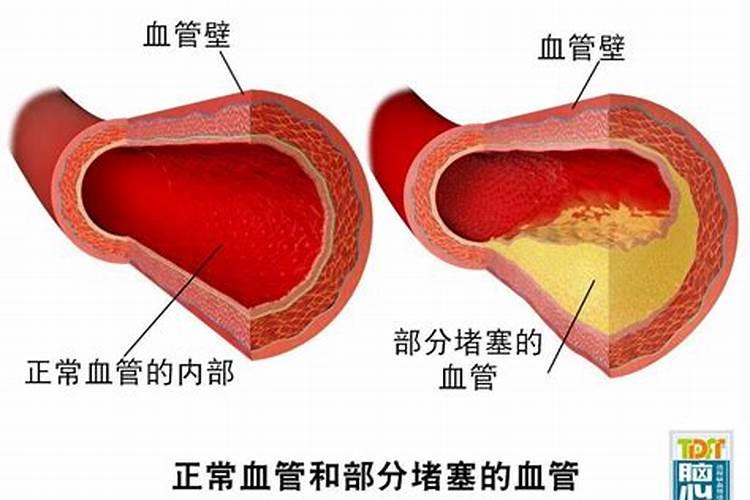 梦到自己血管破了喷血预示着什么意思