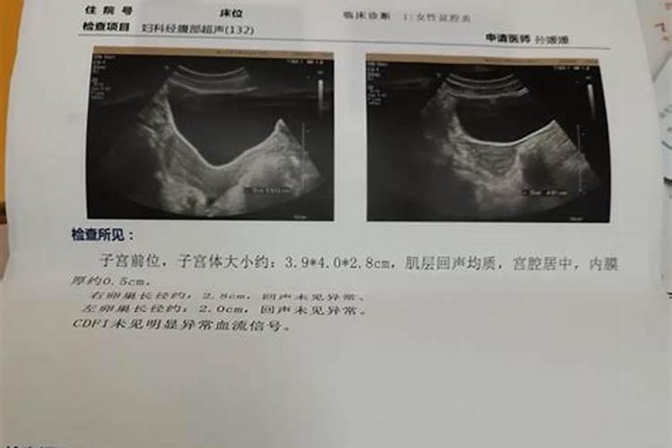 77年的蛇2025年运势和财运怎么样