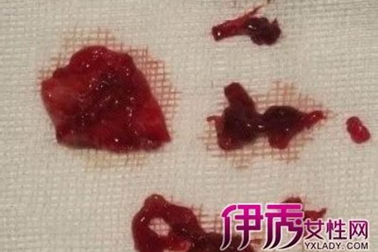 梦见月经来了裤子全是血