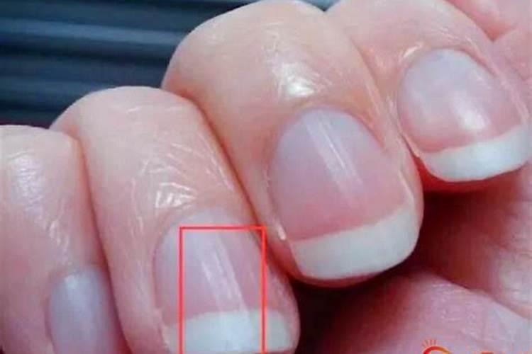 脚底有竖纹是什么运势