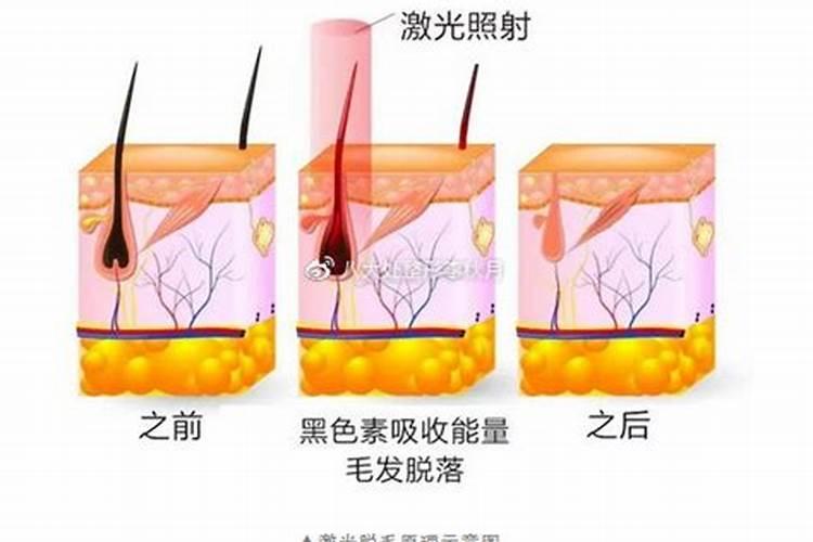 女人痣上长毛是好运吗 女人痣上长毛代表有福气？