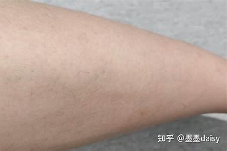 左右两边眉毛不一样高该怎么办？
