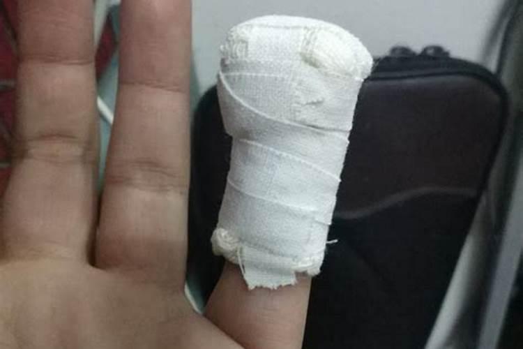 梦见手刀伤口流血的预兆