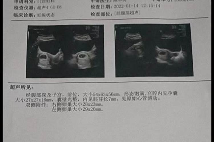 自然流产,用超度吗