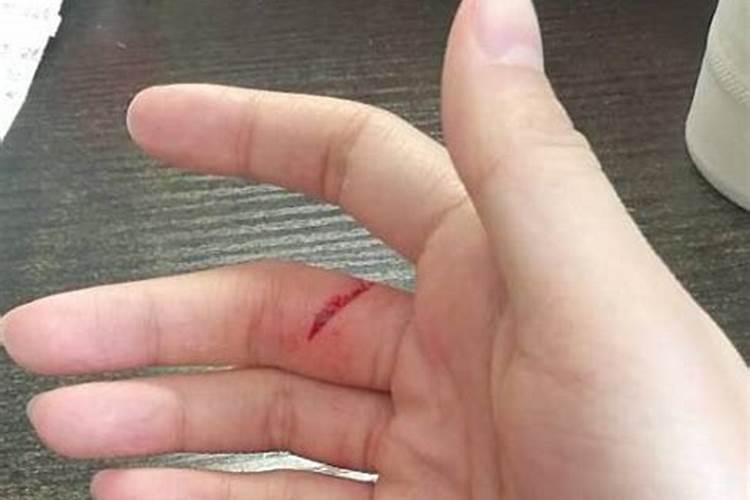 梦见手被划出血的预兆