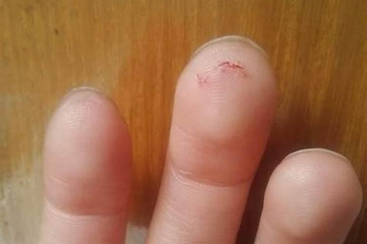 梦见手被划了一条口没出血的预兆