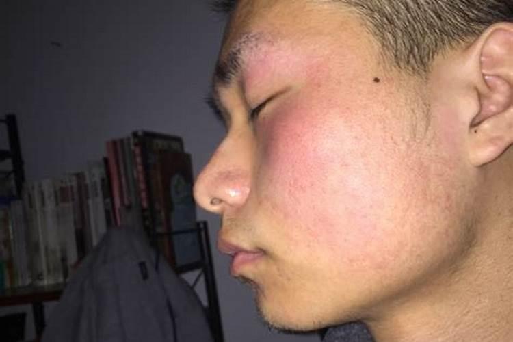 睡觉脸发热是怎么回事